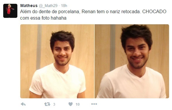 Nariz de Renan, do “BBB16″, em foto antiga que circula nas redes sociais provoca polêmica
