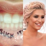 A cantora Kesha achou que era uma boa ideia escrever a palavra "Chupe!" em letras capsulares dentro de seus lábios - imagine o quanto não doeu