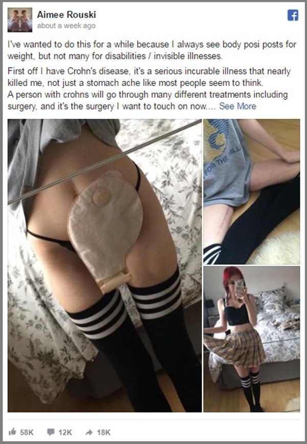 Jovem publica mensagem para motivar pessoas com “doenças invisíveis”