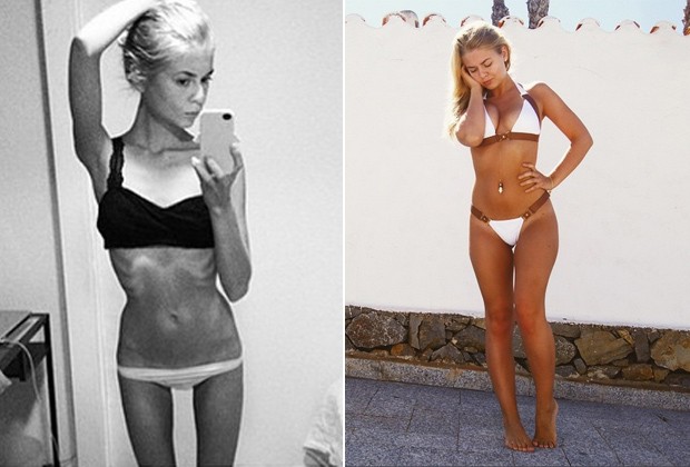 Amalie Lee, em foto de antes e depois publicada no Instagram