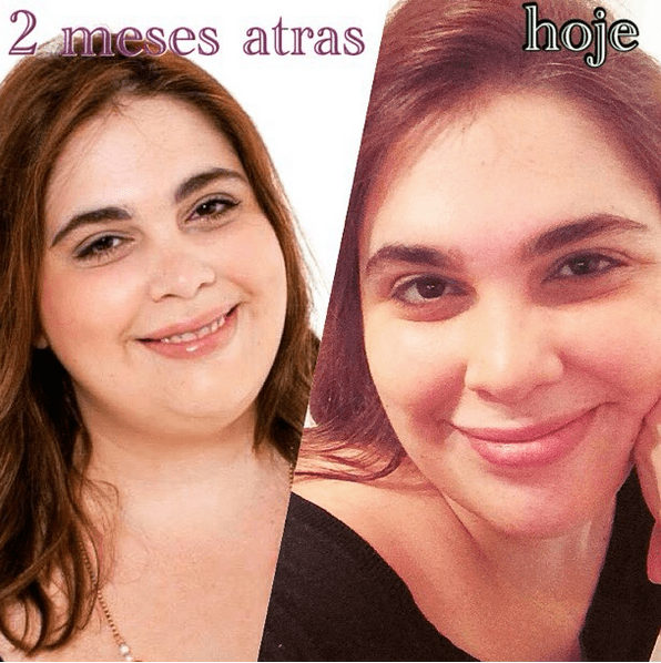 antes-depois-manu1