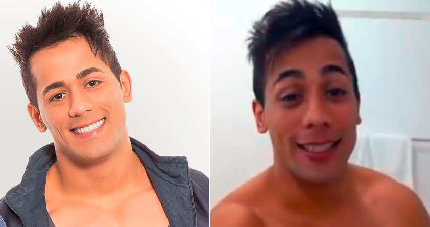 O antes e o depois do sorriso de Tiago, já com o botox (Foto: Montagem)