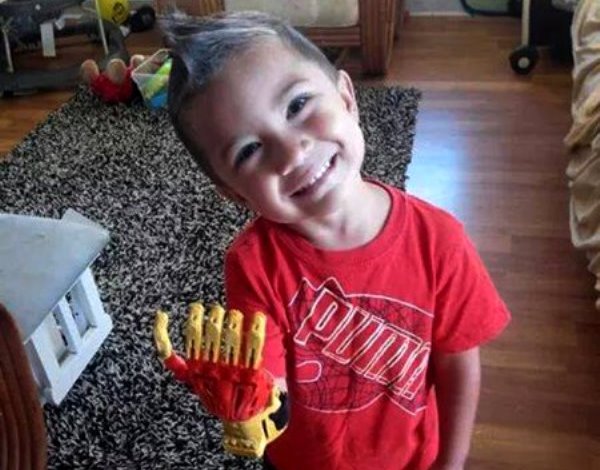 Garotinho que nasceu sem os dedos da mão direita ganha uma mão inspirada no herói ‘Homem de Ferro’