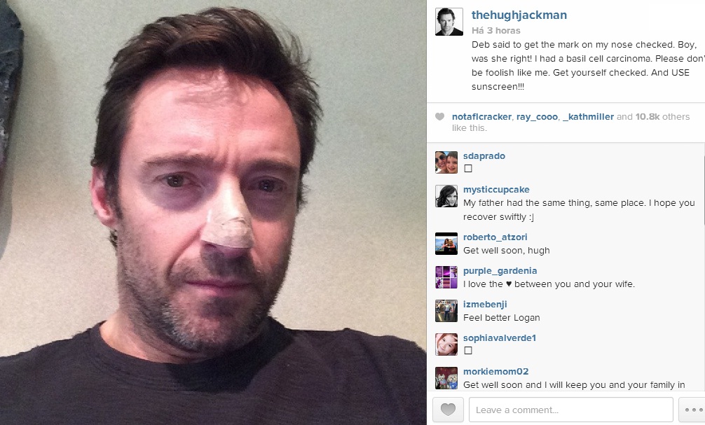 Hugh Jackman é diagnosticado com câncer de pele: “Não sejam tolos como eu, usem protetor solar”