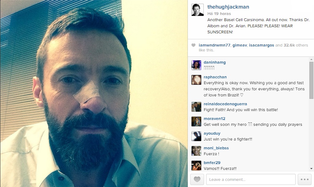 Hugh Jackman - Wolwerine - Câncer de Pele - Instagram