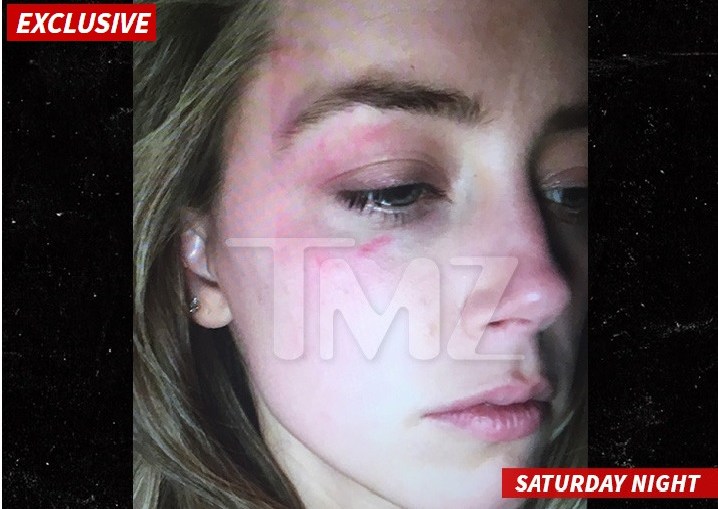 Amber Heard: agressão com celular (foto: reprodução/TMZ)