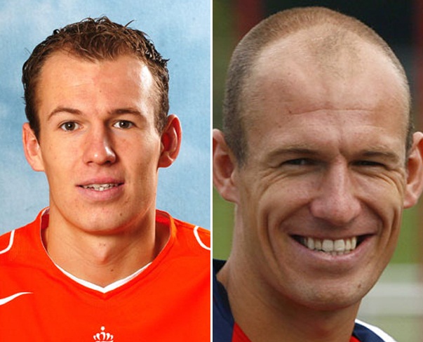 robben1