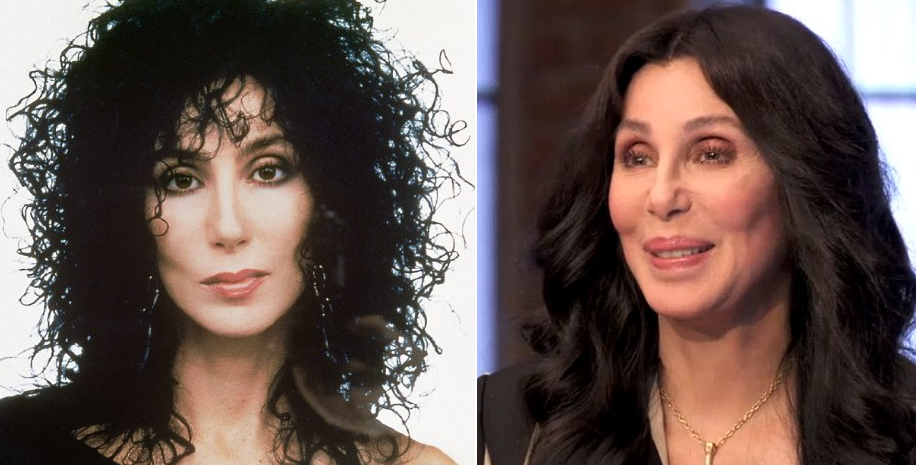Cher é uma das rainhas das plásticas, mas até as divas erram a mão