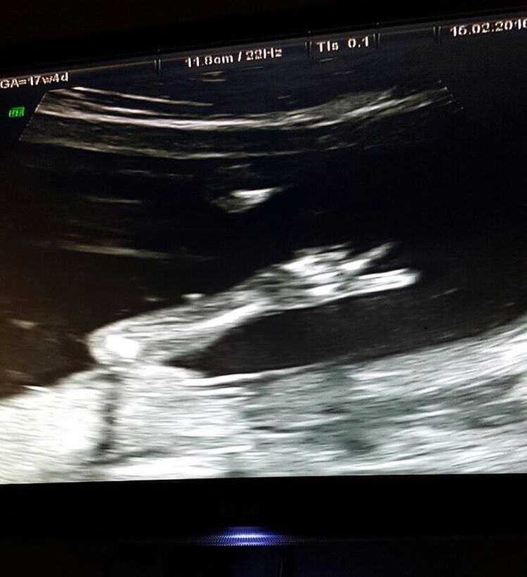 Suzana Alves, a Tiazinha, divulga foto para anunciar gravidez