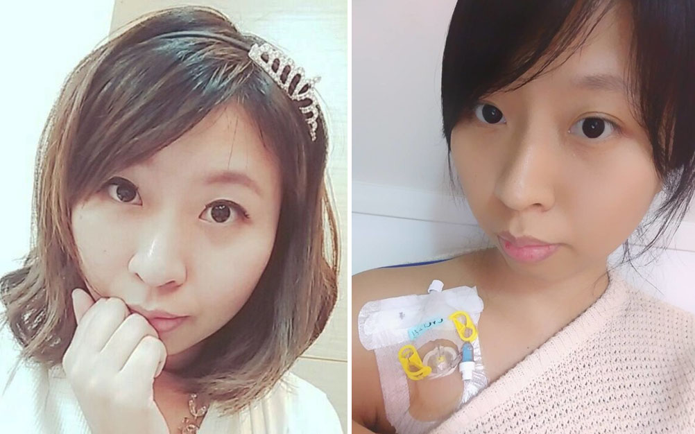 Com câncer terminal, jovem faz “ensaio de casamento” sozinha