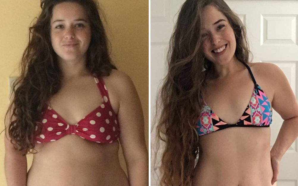 foto-celulite-transformacao-01