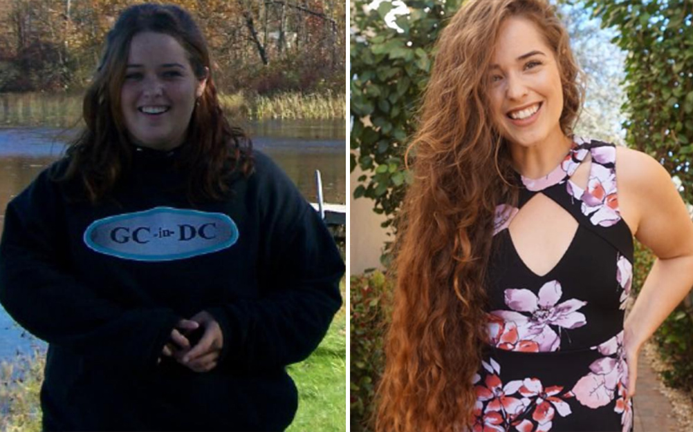 foto-celulite-transformacao-02