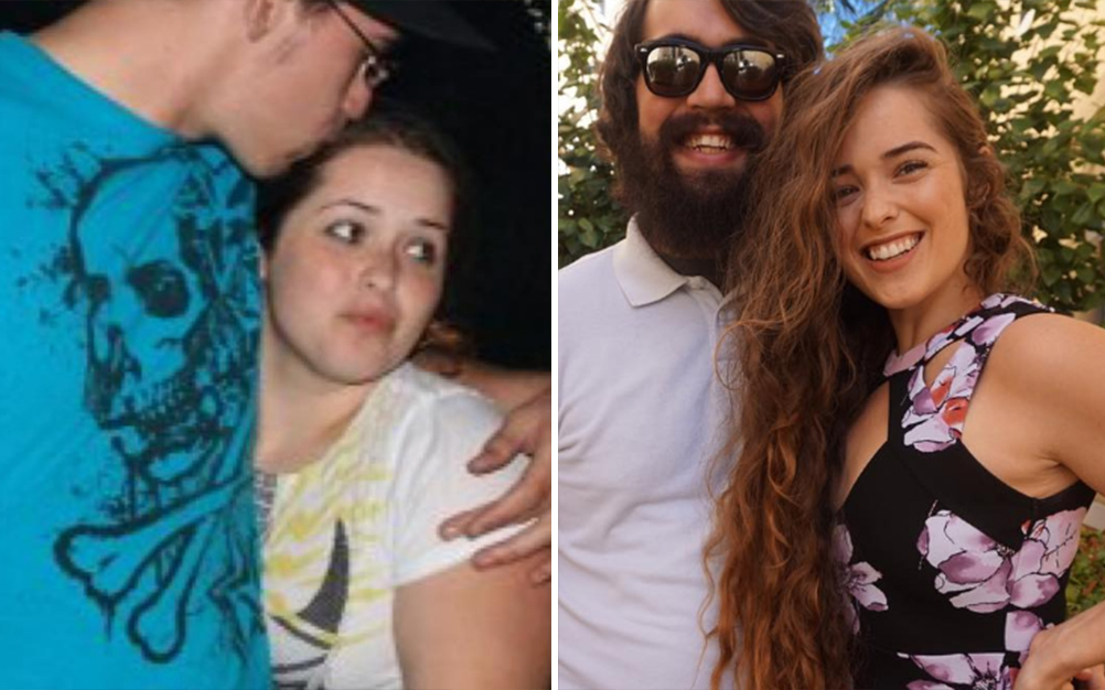 foto-celulite-transformacao-03