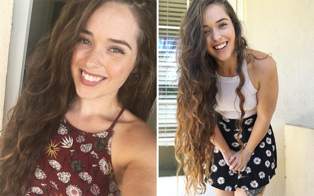 Mulher perde 45 quilos, exibe celulite e responde críticas