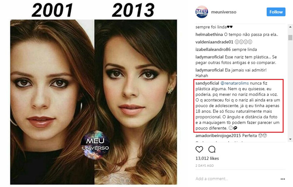 Fã diz que Sandy fez plástica e cantora surpreende ao responder VEJA