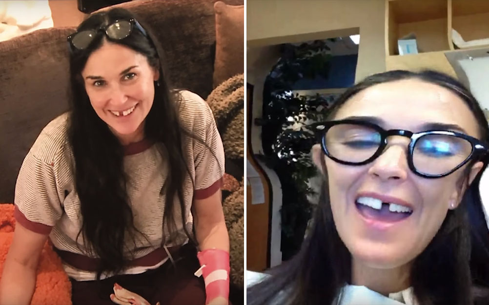 demi-moore-dentes-estresse-01