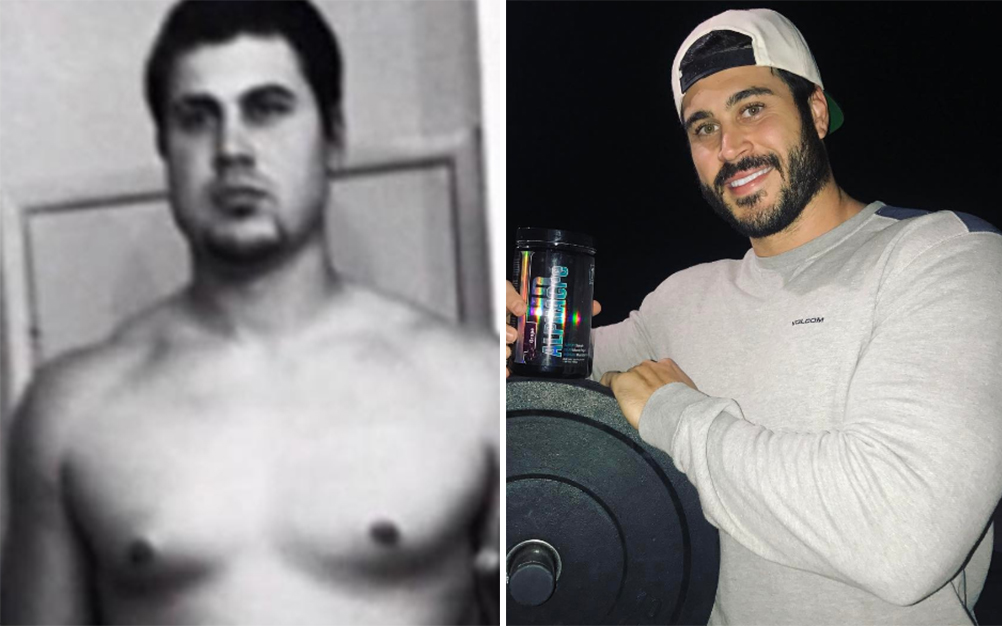 Rapaz recebe o apelido de “homem árvore” e faz sucesso