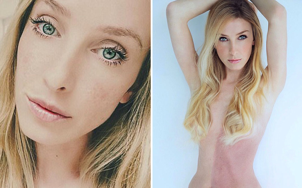 Mulher revela estranho motivo por que tem dois tons de pele