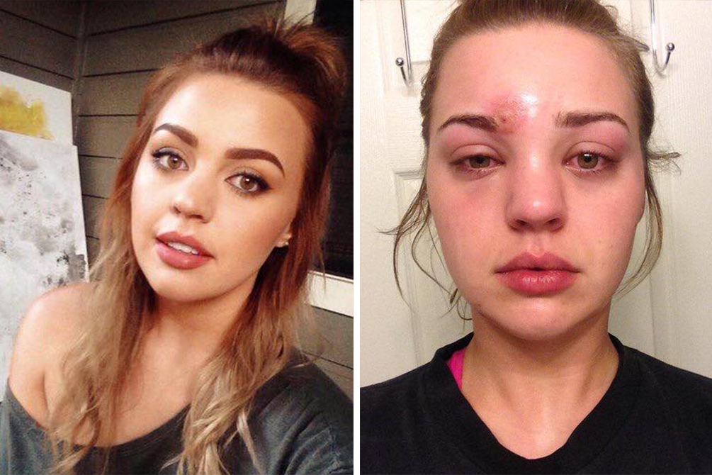 celulite-pincel-maquiagem-01