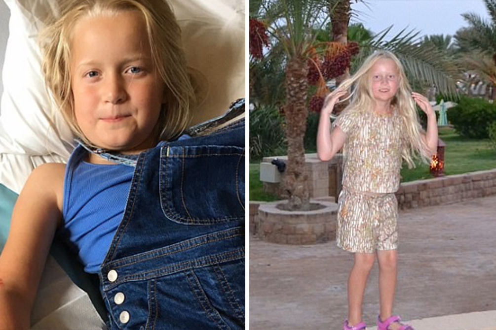 Menina de 7 anos tem queimaduras após fazer tatuagem temporária