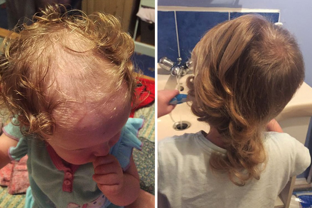 mae-raspa-cabeca-filha-01