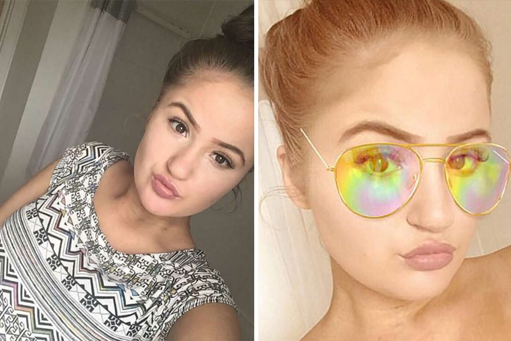 Jovem não consegue sair de casa após “acidente” com bronzeador