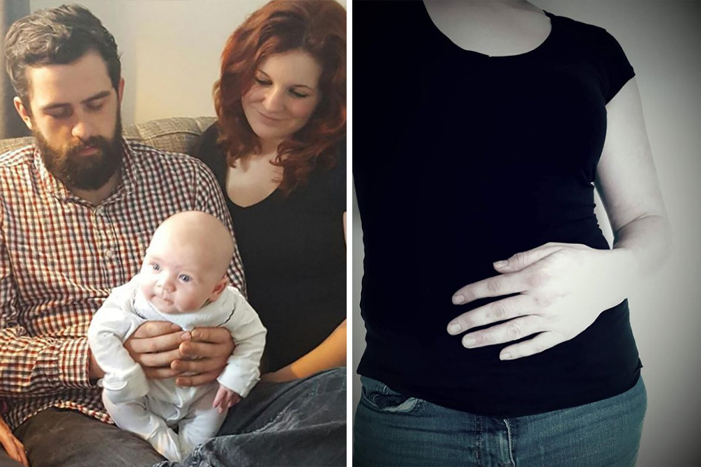 mulher-gravidez-molar-02