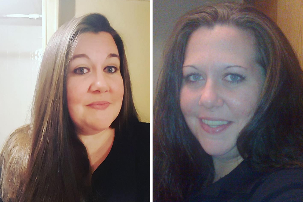 Mãe faz alerta após filha de 19 meses se queimar com carregador