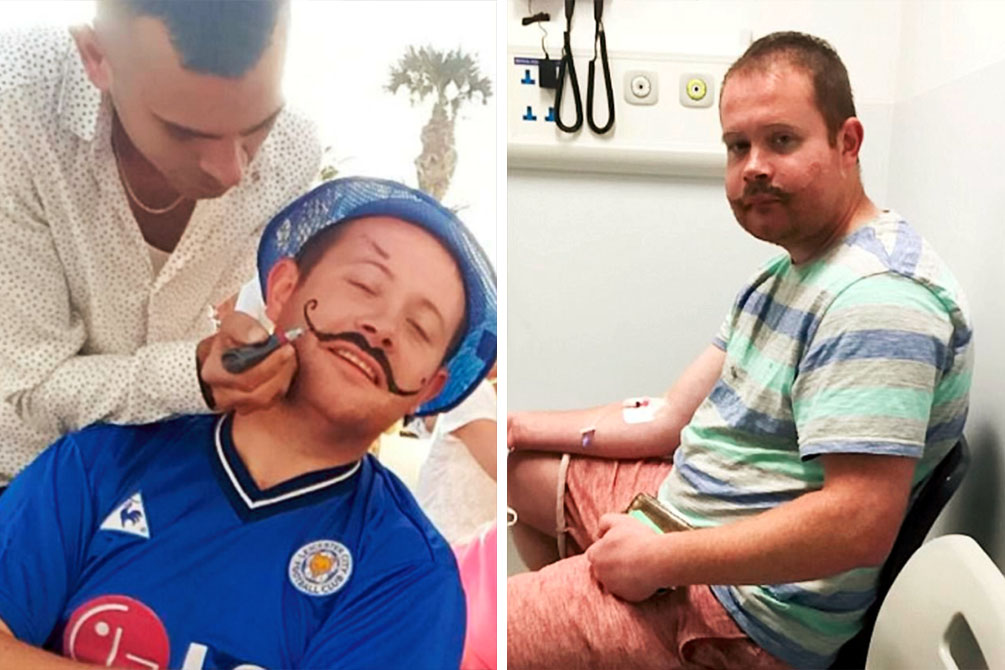 Jovem pode ter cicatriz permanente de bigode após tattoo de henna