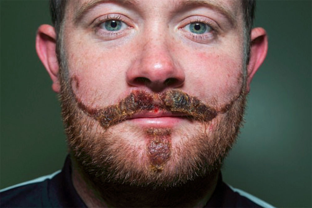 tatuagem-henna-cicatriz-bigode-04