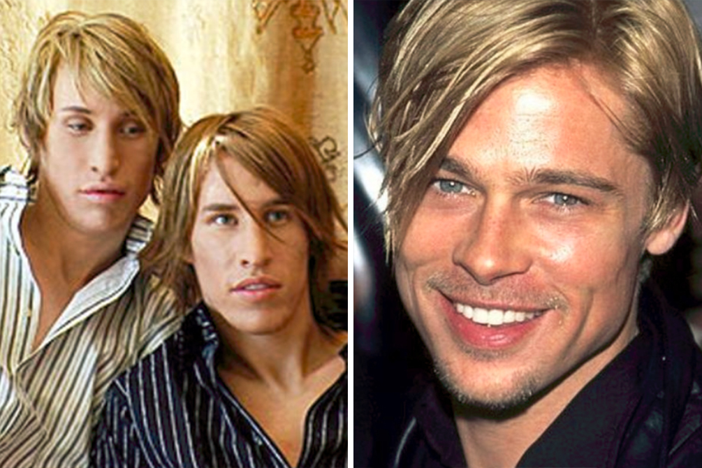 gemeos-cirurgia-plastica-brad-pitt-04