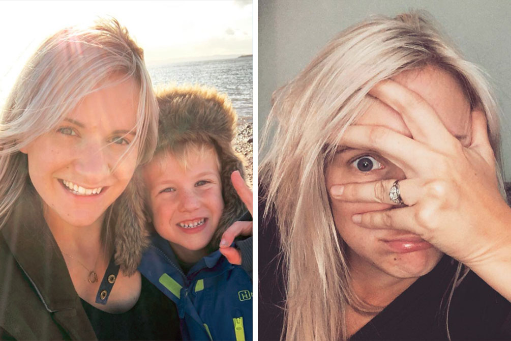 Mãe compartilha foto sincera sobre dar à luz e chama atenção