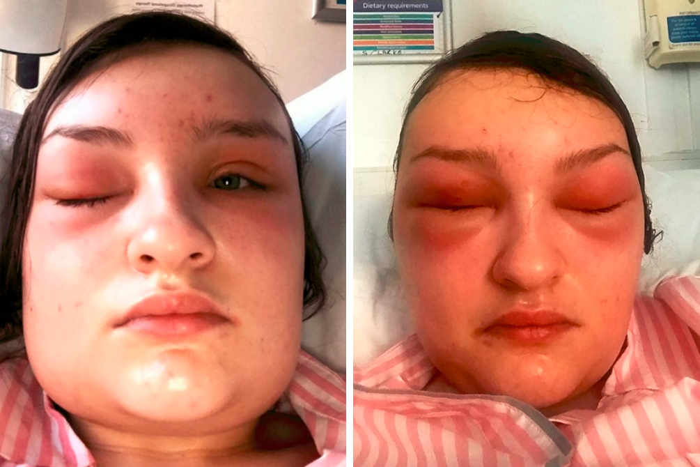 jovem-cancer-facetime-01