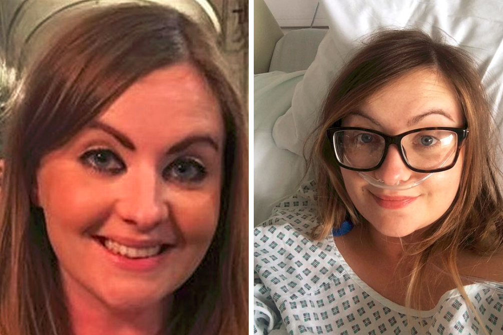 Mulher revela síndrome que faz com que vá ao banheiro 60 vezes por dia