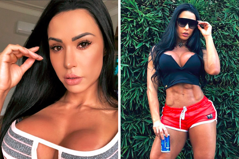 Gracyanne Barbosa revela por que está proibida de engravidar