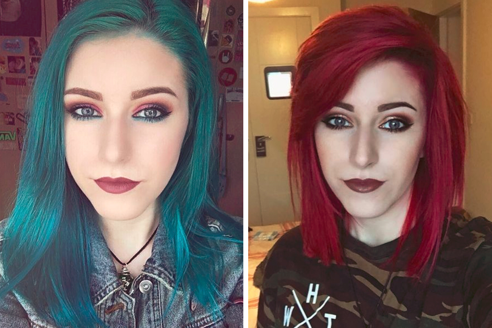 Jovem de 22 anos que acreditava estar anêmica descobre câncer