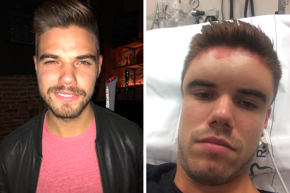 Jovem vai parar no hospital após reação alérgica a tintura de cabelo