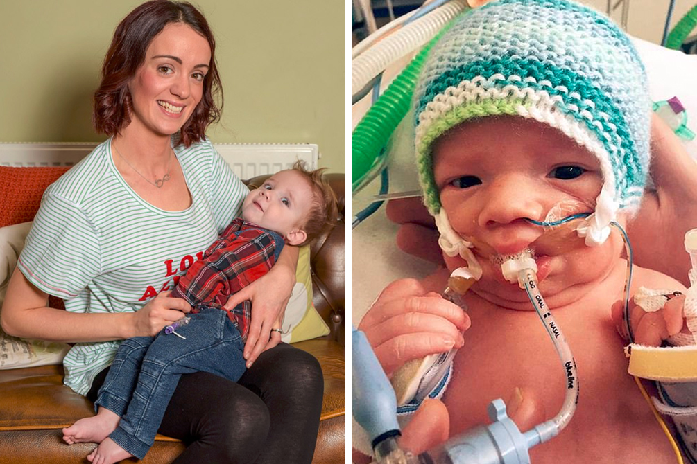 Bebê com morte cerebral sobrevive após desligamento dos aparelhos