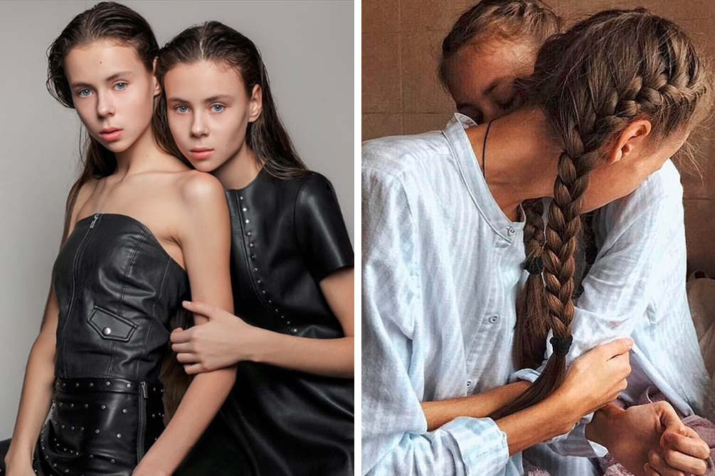 Gêmeas de 14 anos são hospitalizadas após pedido de agência de modelos 