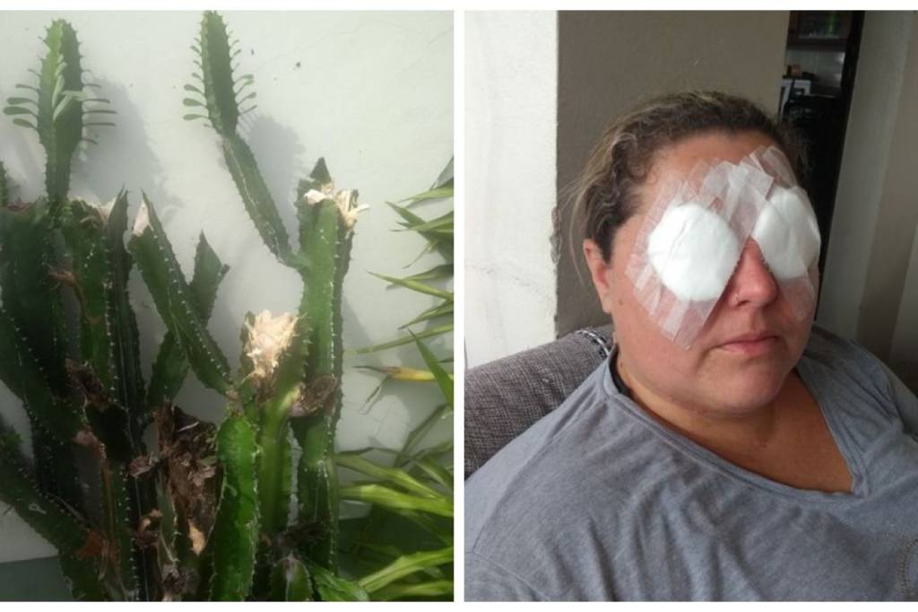 Mulher tenta podar planta em casa e vai parar no hospital | VEJA SÃO PAULO