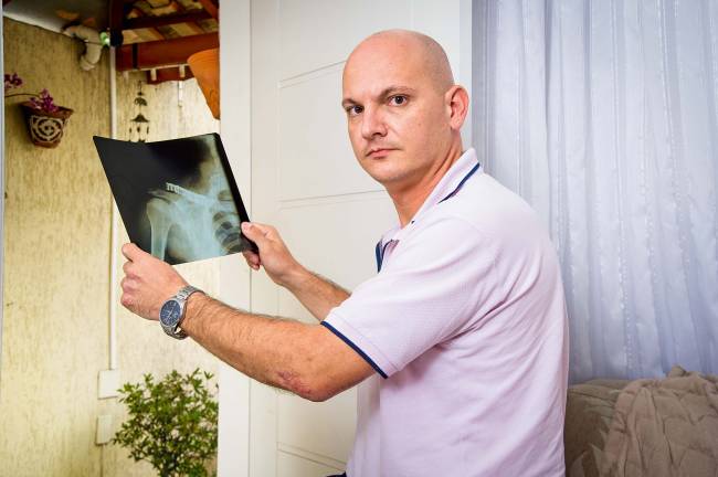 Motociclista acusa o vereador Milton Leite de provocar acidente grave