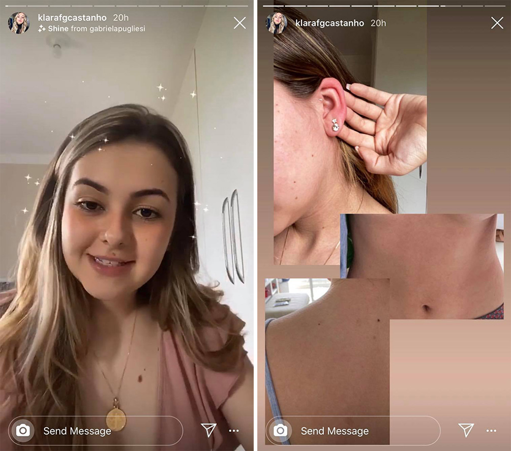 klara-castanho-alerta-alergia-03