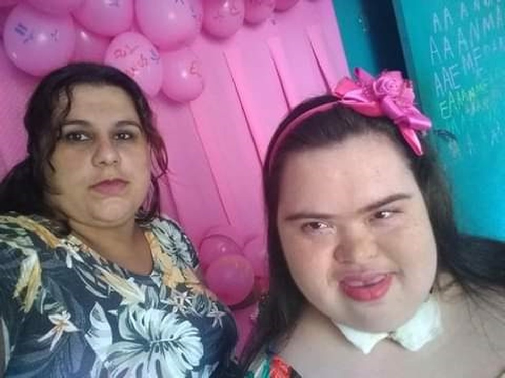 Jovem de 21 anos com Down que venceu Covid morre após reinfecção