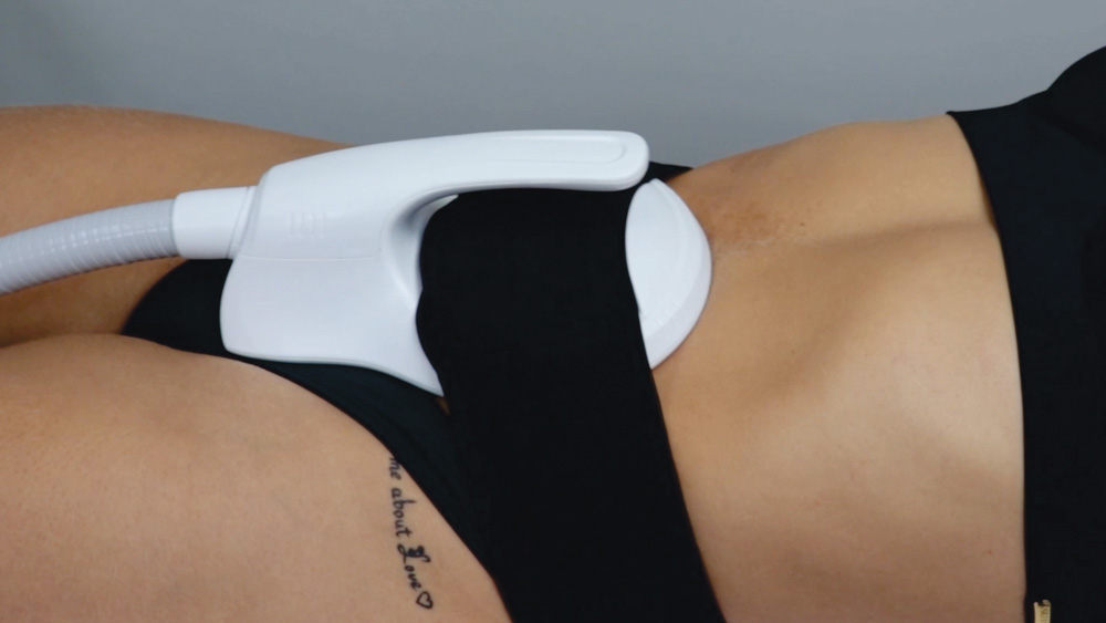 imagem da cintura de mulher com o equipamento t sculptor acoplado