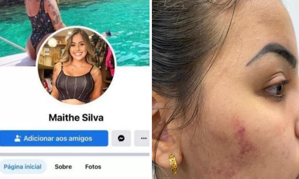 A montagem mostra duas imagens. À esquerda, um print de um perfil fake criado no Facebook com o nome de Maithê Silva. À direita, a bochecha de Maithê com um roxo.