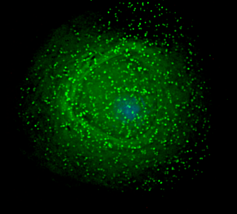Envoltório verde junto a uma estrutura azul: HIV junto a uma célula de defesa