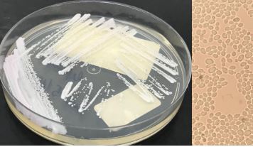 Colônias de superfungo desenvolvidas em laboratório