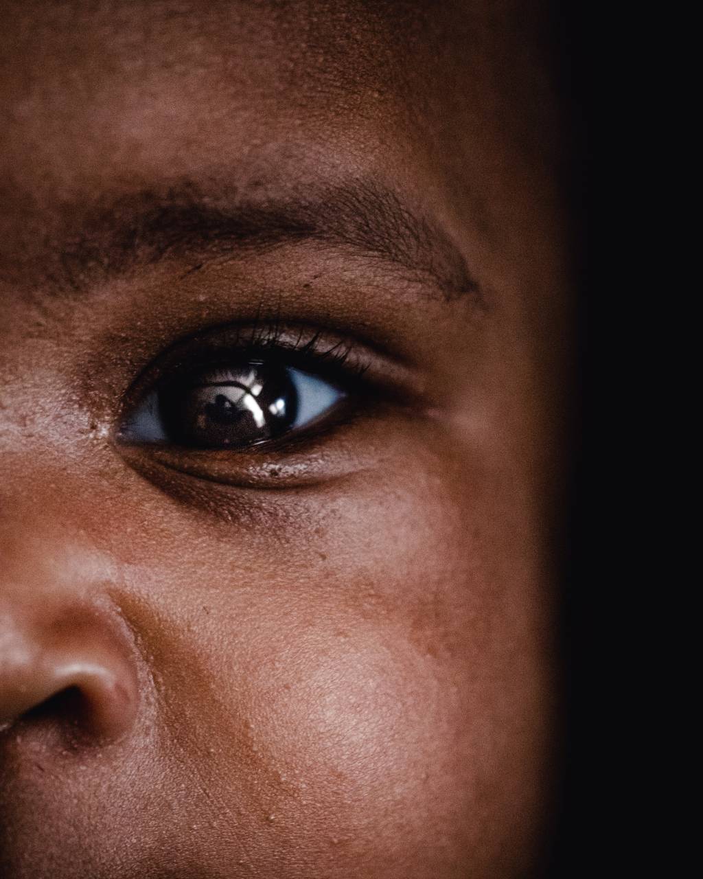 A imagem mostra o olho de uma criança