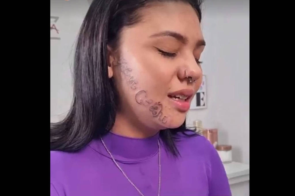 Tayane Caldas, que retira tatuagem do rosto