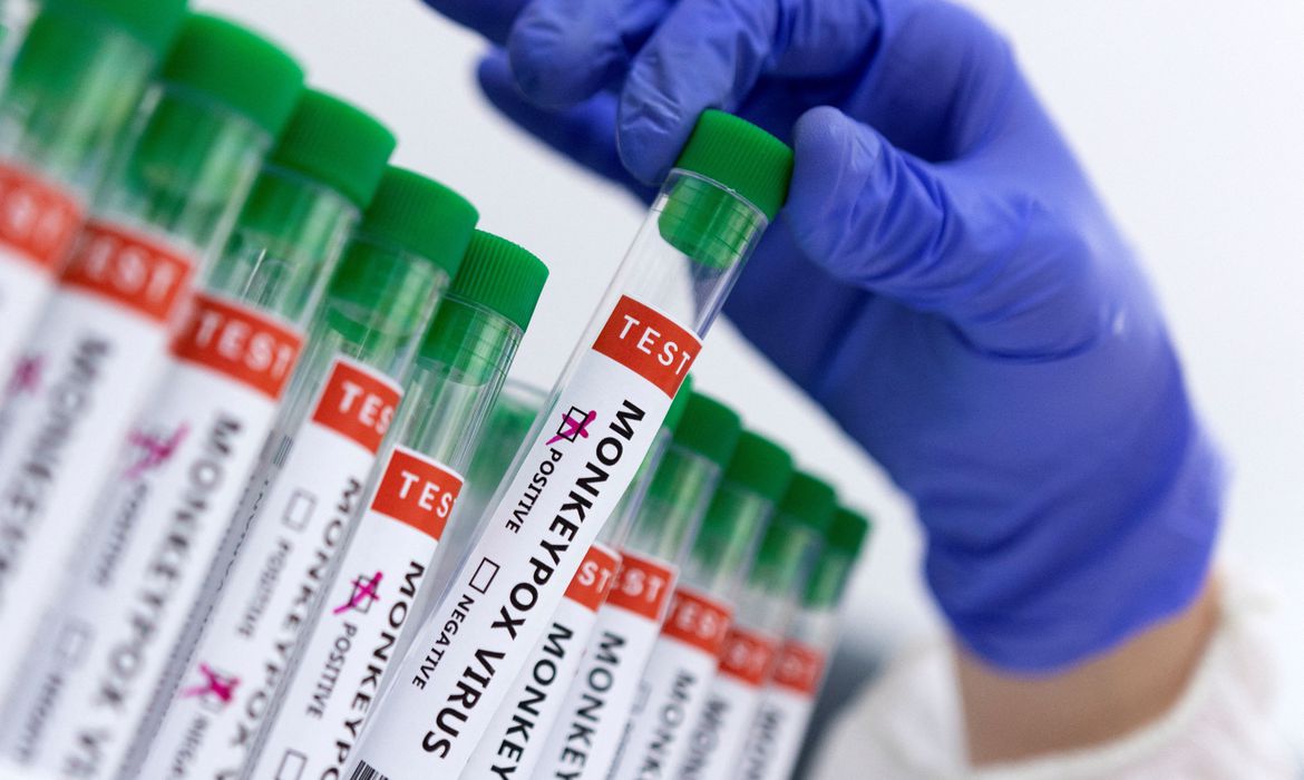 Médico coleta amostra de vírus da varíola dos macacos de tubo de ensaio escrito monkeypox